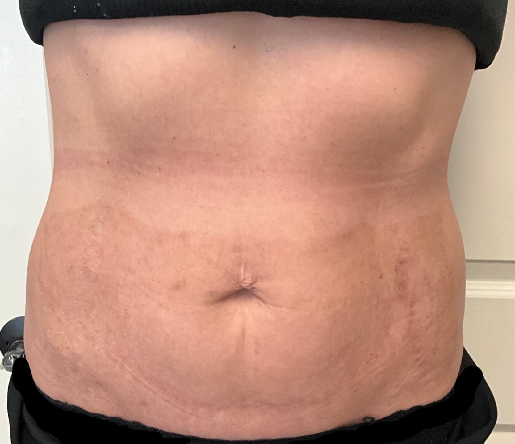 Partial view of a person's torso with a focus on the abdomen.